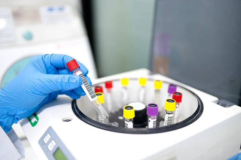 Jreissati Pancreatic Centre